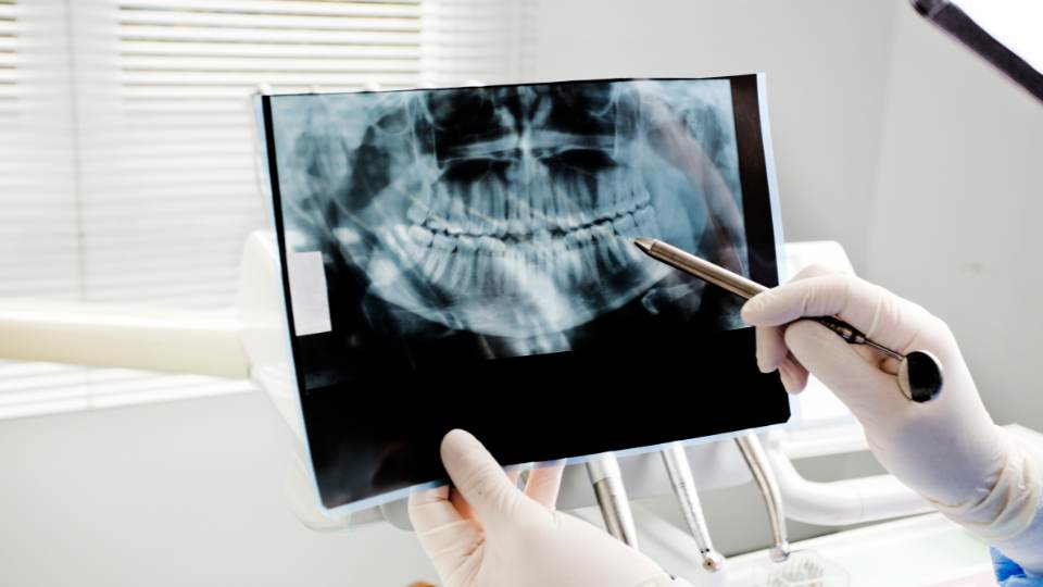 Dental x-ray